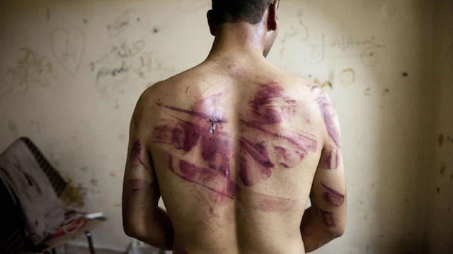 Suriye hapishanelerinde binlerce sivil işkence nedeniyle hayatını kaybetti.