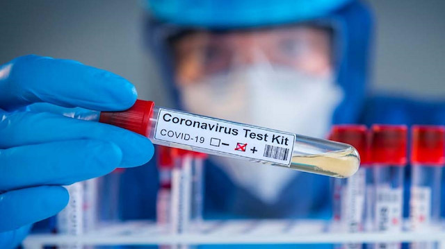 Türkiye'de koronavirüs test sayısı 1 milyona yaklaştı.