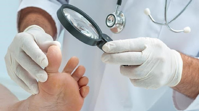 Prof. Dr. Ceyhan açıkladı: Koronavirüste ayak parmaklarının rengi neden değişiyor?