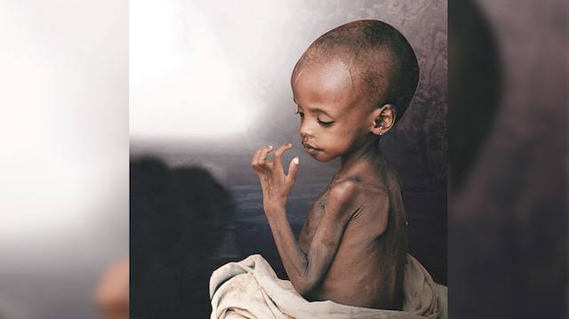 En tehlikeli virüs açlık: Her gün 8220 çocuk açlıktan ölüyor
