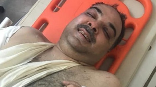 Enkazdan ağırlı yaralı olarak çıkartılan Zafar Masud  tedavi altına alındı.