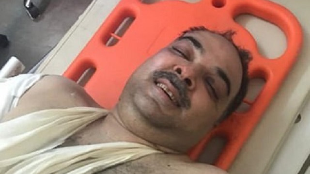 Enkazdan ağırlı yaralı olarak çıkartılan Zafar Masud  tedavi altına alındı.