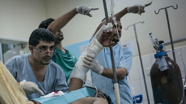 Yemen'deki resmi verilerde, 399 kişinin Kovid-19 hastası olduğu, bunlardan 84'ünün hayatını kaybettiği, 14 kişinin iyileştiği belirtiliyor. 

