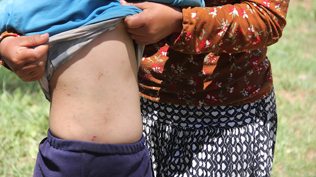 Zara ilçe merkezine 70 kilometre mesafede bulunan Kardere köyü ve mezralarında, ormanlık alandan yerleşim yerlerine kadar inen tırtıllar bölge halkını tedirgin ederken, bitki örtüsüne de zarar veriyor.