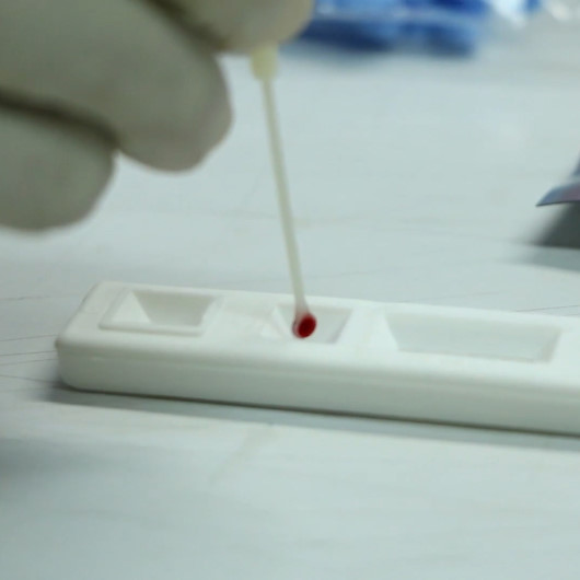 Endonezyada uygun fiyatlı koronavirüs test kiti geliştirildi