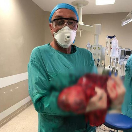 Gaz şişkinliği sandı karnından 3 bebek büyüklüğünde tümör çıktı