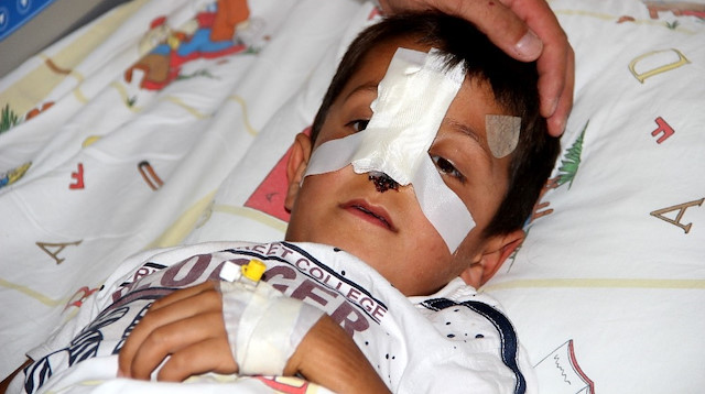 7 yaşındaki Bünyamin, sokak köpeklerinin saldırısına uğradı burnu koptu.