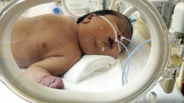 Erkek dedikleri bebek kız çıktı aile hastaneden şikayetçi oldu.