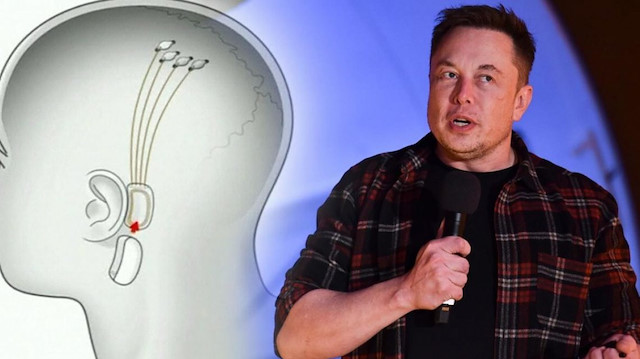 Elon Musk yeni projesiyle ilgili detay verdi: Beyin çipiyle duyulamayan sesleri duyuracak