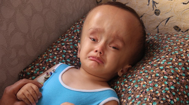 2 yaşındaki hidransefali rahatsızlığı bulunan Sercan Gezenler için herkes seferber oldu.