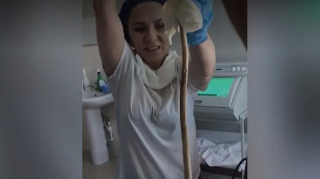 Rusya'da uyuyan kadının ağzından giren yılan ameliyatla çıkarıldı. 