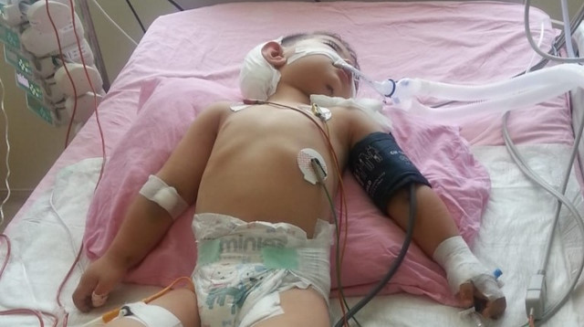Sokakta oyun oynayan Irak uyruklu 3 yaşındaki Abdurrahman Saleh Khalıd Al-Atallah kafasından vurulmuştu.