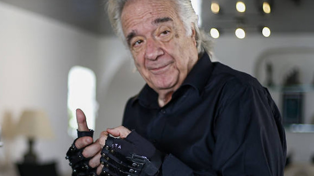 Bionic gloves help keep the music playing for Brazilian pianist