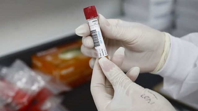 Pfizer'ın aşısı koronavirüsü yüzde 90 önledi.