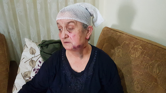 Yaşlı kadın, bileziklerini almaya çalışan saldırgandan ölü taklidi yaparak kurtuldu. 