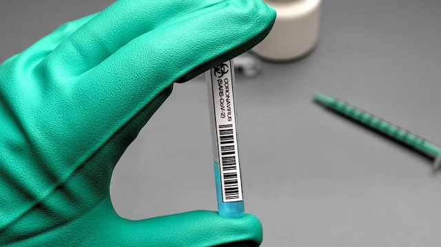 Pfizer'ın aşısı koronavirüsü yüzde 90 önledi. 
