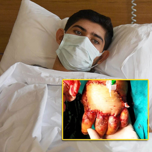 Mikrocerrahide bir ilk: Makinede parçalanan eli Türk doktorların müdahalesi kurtardı