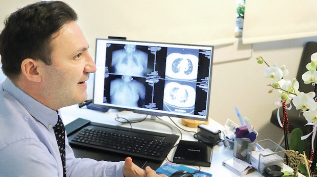 55 yaşında ve 1 hafta ilaç kullanmayan pozitif hastanın akciğerlerindeki inanılmaz değişimi tomografi sonuçlarında ortaya çıktı.