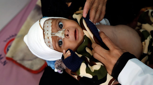 Yemen remains 'worst humanitarian crisis': UN office