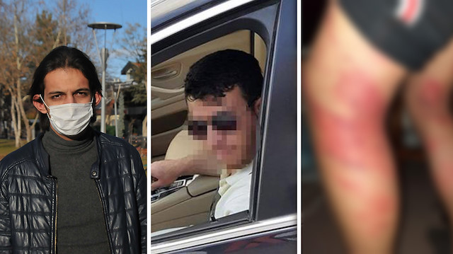 Fatih Saka, Mustafa Ayıntablıyım'ı triger kayışıyla öldüresiye dövdü.