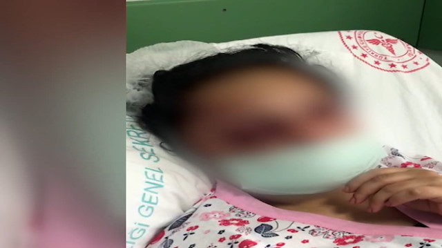 Eski eşi tarafından küçük çocuğunun önünde öldüresiye dövülen kadın konuştu