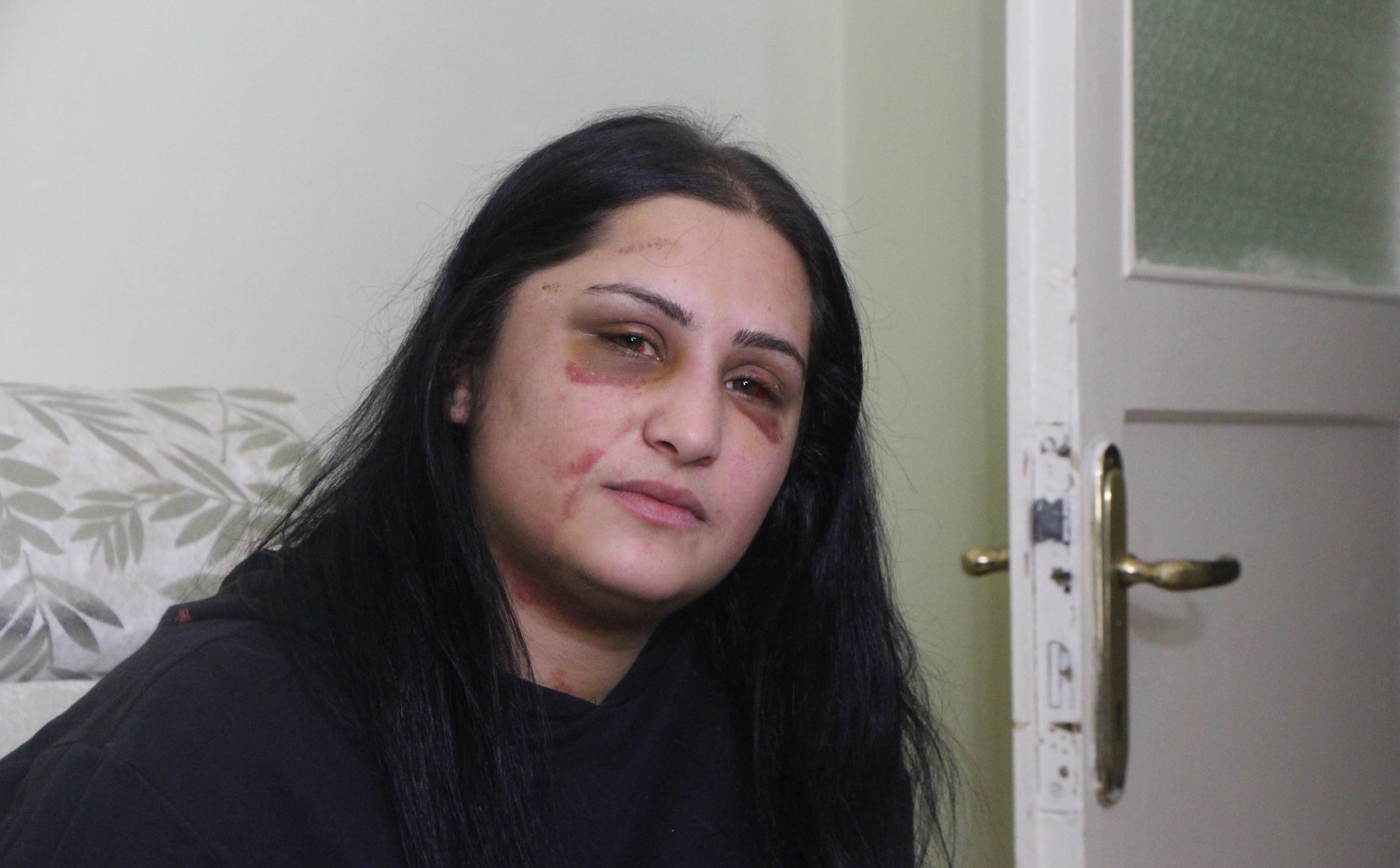Emriye Metegül,5 gün sonra tedavi gördüğü Eğitim ve Araştırma Hastanesi’nden taburcu oldu.