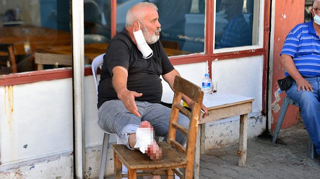 Silahlı saldırıda ayağından yaralanan Edip Özşahin, olayı yanındakilere gülerek anlattı.