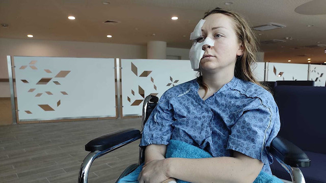 28 yaşındaki Ukrayna uyruklu Anna Butim eski eşi tarafından falçatalı saldırıya uğradı.