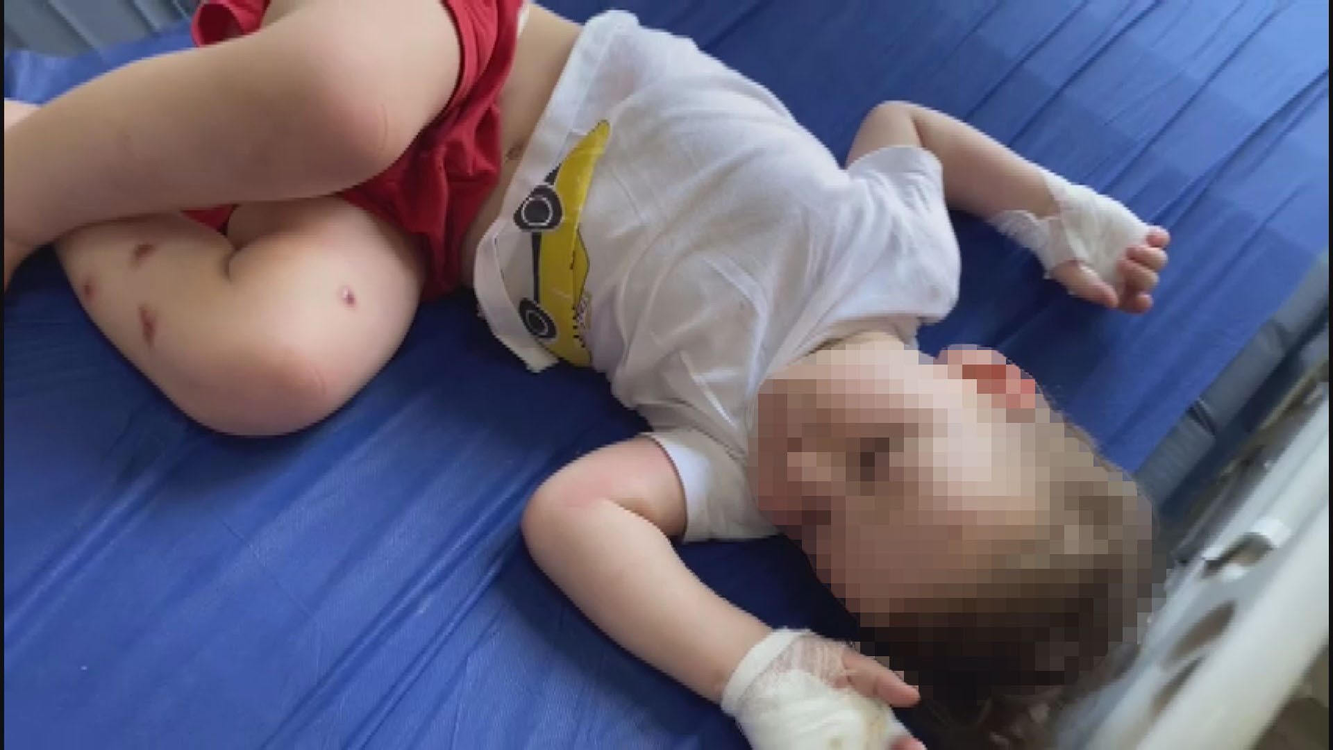 Seyf bebek hastanede tedavi altına alındı.
