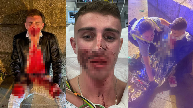 Boksör Jack Woolley, saldırı görüntülerini sosyal medya hesabından paylaştı