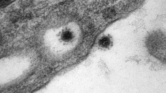 Koronavirüsün delta varyantı ilk kez görüntülendi