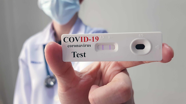 Test kiti koronavirüsü ve antikor oranını etkili bir şekilde tespit edebilecek.