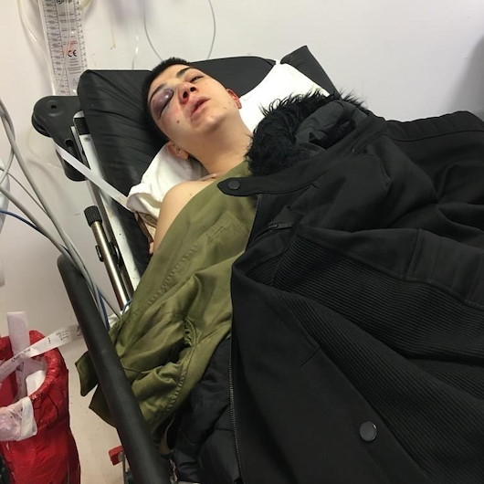 Taksim’de genç kızı felç eden öldüresiye dayak: Ameliyata girersek elimde kalırsın