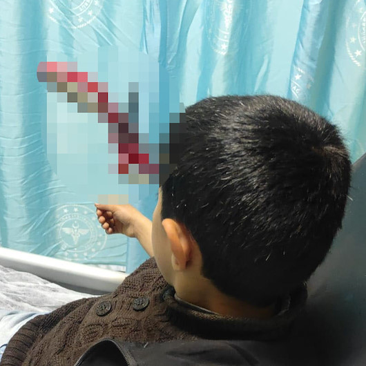 Siirt'te 10 yaşındaki çocuğun kafasına saplanan makas operasyonla çıkarıldı