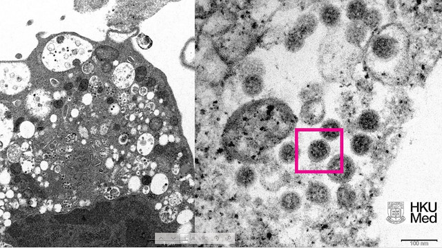 Omicron varyantının elektron mikroskobu görüntüsü ortaya çıkarıldı. 