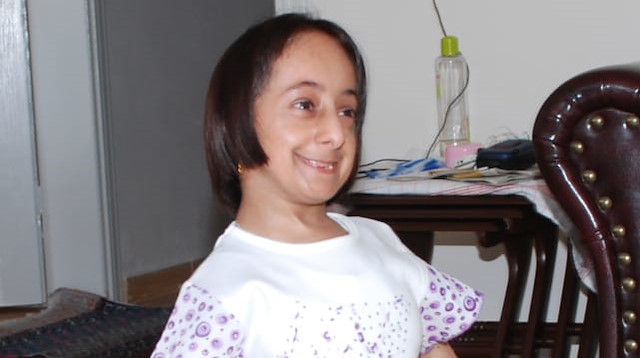 Türkiye'nin en kısa boylu kadını Elif hayatını kaybetti.