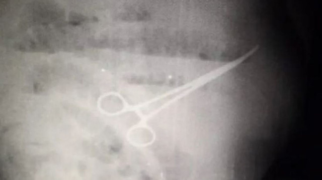 Hastanın röntgen filmi