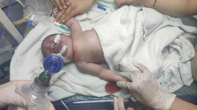 Yeni doğan bebeğin yoğun bakım ünitesinde tedavisine devam ediliyor.