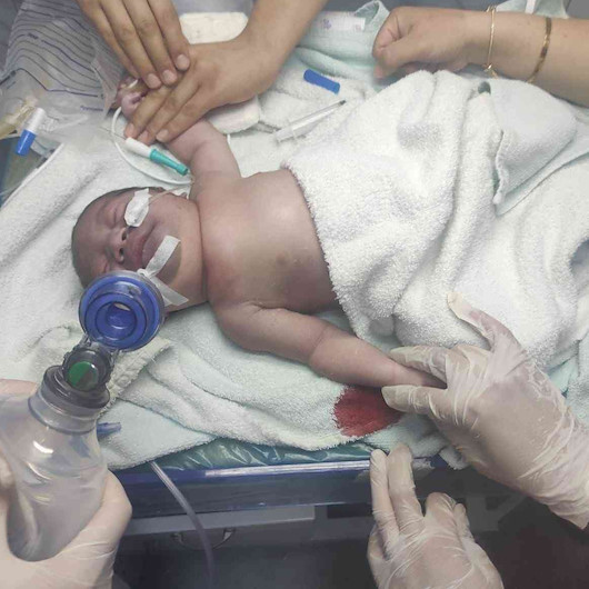 Akılalmaz olay: Yeni doğan bebeğin köprücük kemiği kırıldı, vücudu mosmor oldu