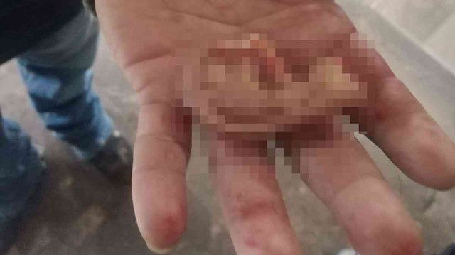 Meksika’da metroda kavga eden iki kişiden biri diğerinin kulağını koparttı.