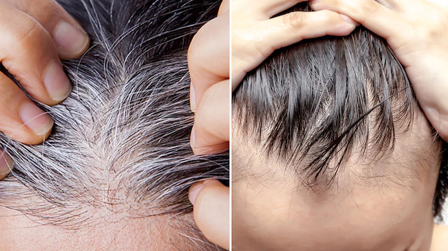 Umutlandıran araştırma: Saç beyazlaması ve dökülmesi engellenebilir