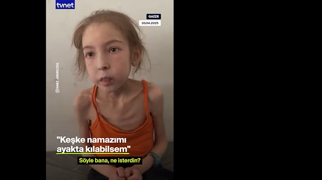 İsrail’in açlığa mahkum ettiği Rahaf’ın durumu kötüleşiyor