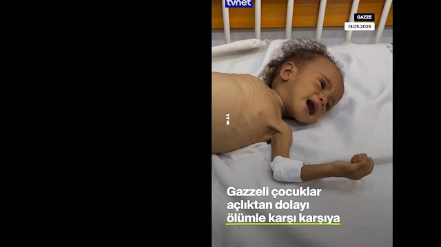 Gazze'de bebekler açlıktan ölüyor