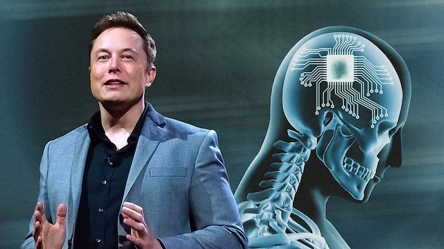 Elon Musk'ın beyin çipi Neuralink'e yeni rakip: İlk insan testi gerçekleştirildi