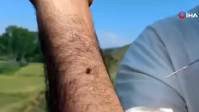 Yozgat'ta korkutan görüntü: Keneler tarafından adeta kovalandı 'Kenenin radarına girince kaçamıyorsun'