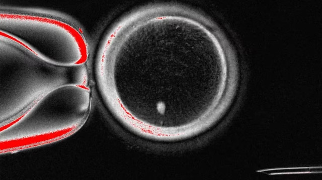 Tıpta yeni dönem: Deri hücresinden yumurta hücresi üretildi