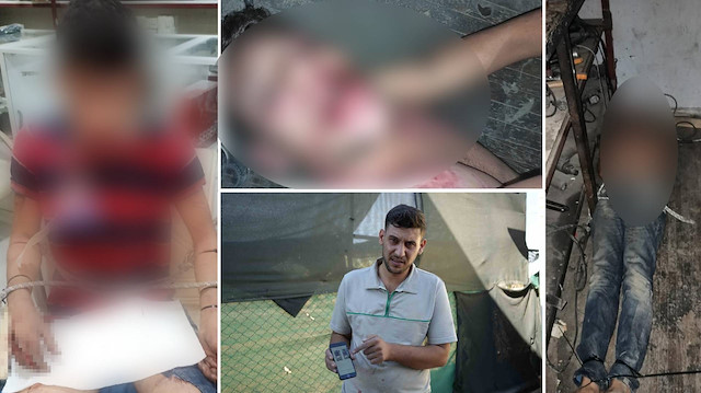 Antalya'da korkunç olay! Sadece maaşını istedi, 3 gün boyunca vahşice işkence gördü: Böcek yedirip dişlerimi kırdılar