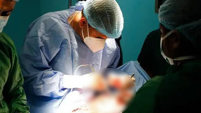 Her kan grubuna uygun “evrensel böbrek” geliştirildi: Organ naklinde devrim