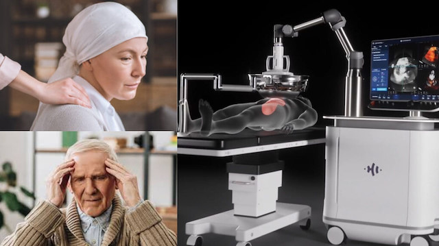 Kanser ve Alzheimer tarihe mi karışıyor? Duyamadığımız seslerle tedavi dönemi başlıyor