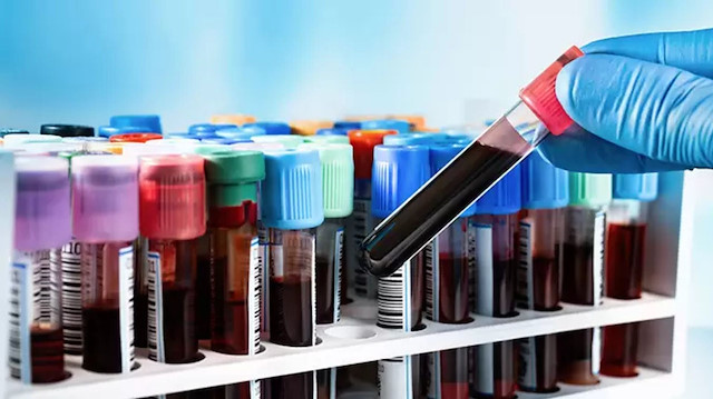 Kanser taramasında devrim: 50’den fazla kanseri tespit edebilen kan testi geliştirildi